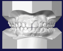 Принципы 3D диагностики в ортодонтии - цикл НМО - набор балов ЗТЕ